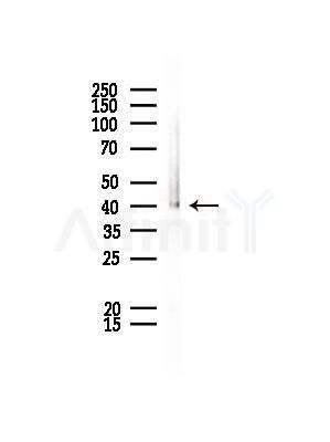 TRIM63 Antibody - Western blot analysis of lysates from EC304 cells, using TRIM63 Antibody at 1/1000 dilution.