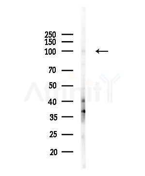 MYSM1 Antibody - Western blot analysis of lysates from HUVEC cells(UV,30min treatment), using MYSM1 Antibody at 1/1000 dilution.
