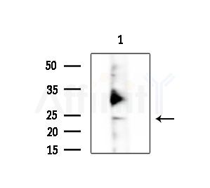 PTN Antibody - Western blot analysis of extracts from Rat lung, using PTN Antibody at 1/1000 dilution.