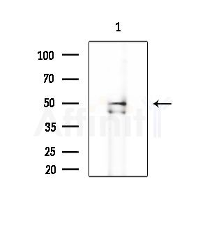 SCTR Antibody - Western blot analysis of extracts from EC304 cells, using SCTR Antibody at 1/1000 dilution.