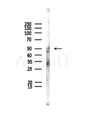 SCTR Antibody - Western blot analysis of lysates from EC304 cells, using SCTR Antibody at 1/1000 dilution.