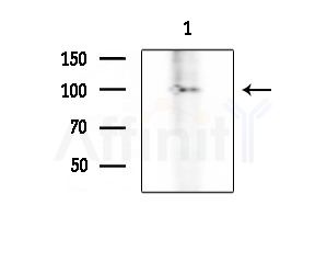 PIWIL4 Antibody - Western blot analysis of extracts from HepG2 cells(LPS 4h treatment), using PIWIL4 Antibody at 1/1000 dilution.