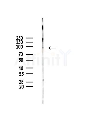 PIWIL4 Antibody - Western blot analysis of lysates from HepG2 cells(LPS,4h treatment), using PIWIL4 Antibody at 1/1000 dilution.
