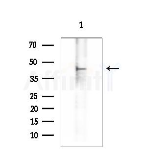 CHI3L1 Antibody - Western blot analysis of extracts from Rat liver, using CHI3L1 Antibody at 1/1000 dilution.