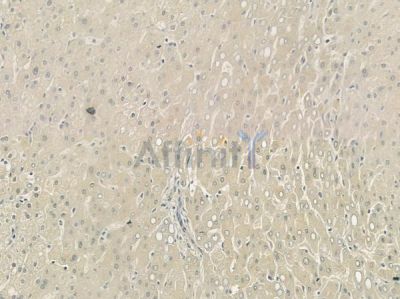 CHI3L1 Antibody - DF7223 at 1/100 staining human normal liver tissue by IHC-P.