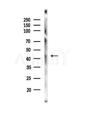 CHI3L1 Antibody - Western blot analysis of lysates from Rat liver, using CHI3L1 Antibody at 1/1000 dilution.