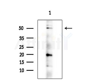 CSF2RA Antibody - Western blot analysis of extracts from HepG2 cells(LPS 4h treatment), using CSF2RA Antibody at 1/1000 dilution.