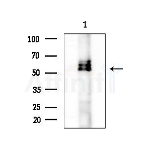 CSF2RA Antibody - Western blot analysis of extracts from RAW264.