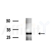 LCN2 Antibody - Western blot analysis of extracts from various samples, using LCN2 Antibody at 1/1000 dilution.
