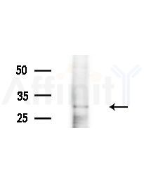 LCN2 Antibody - Western blot analysis of extracts from EC304 cells
(heat-shock treatment), using LCN2 Antibody at 1/1000 dilution.