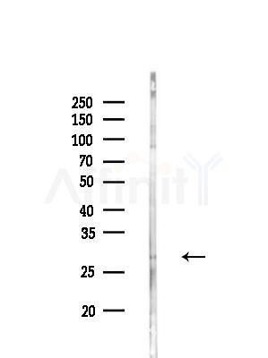 LCN2 Antibody - Western blot analysis of lysates from EC304 cells(heat-shock treatment), using LCN2 Antibody at 1/1000 dilution.