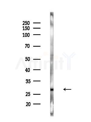 LCN2 Antibody - Western blot analysis of lysates from B16F10-LUC cells(LPS,4h treatment), using LCN2 Antibody at 1/1000 dilution.