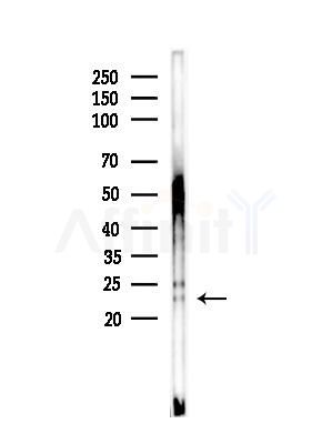 NTF4 Antibody - Western blot analysis of lysates from Rat liver, using NTF4 Antibody at 1/1000 dilution.