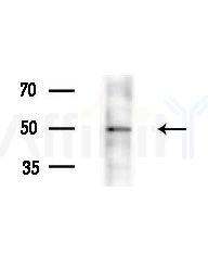 TUBA4A  Antibody - Western blot analysis of extracts from various samples, using TUBA4A  Antibody at 1/1000 dilution.