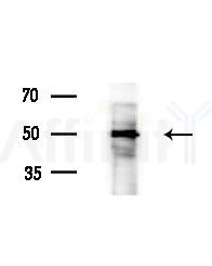 TUBA4A  Antibody - Western blot analysis of extracts from EC304 cells
(heat-shock treatment), using TUBA4A  Antibody at 1/1000 dilution.