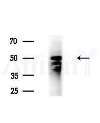 TUBA4A  Antibody - Western blot analysis of extracts from Mouse testis, using TUBA4A  Antibody at 1/1000 dilution.