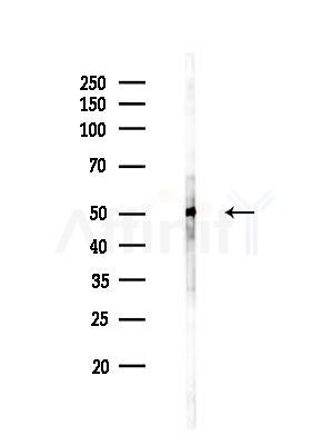 TUBA4A  Antibody - Western blot analysis of lysates from EC304 cells(heat-shock treatment), using TUBA4A  Antibody at 1/1000 dilution.
