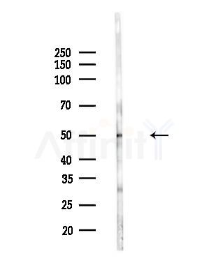 TUBA4A  Antibody - Western blot analysis of lysates from B16F10-LUC cells(LPS,4h treatment), using TUBA4A  Antibody at 1/1000 dilution.
