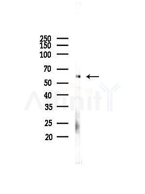 NLK Antibody - Western blot analysis of lysates from COLO205 cells(UV,30min treatment), using NLK Antibody at 1/1000 dilution.