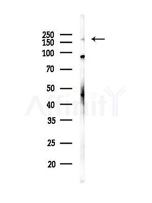 Abca6 Antibody - Western blot analysis of lysates from K562 cells, using Abca6 Antibody at 1/1000 dilution.