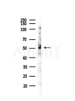 RRM2 Antibody - Western blot analysis of lysates from LoVo cells(heat-shock,45min treatment), using RRM2 Antibody at 1/1000 dilution.