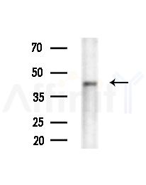 KMT5A Antibody - Western blot analysis of extracts from various samples, using KMT5A Antibody at 1/1000 dilution.