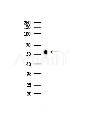 Nono Antibody - Western blot analysis of lysates from HepG2 cells(LPS,4h treatment), using Nono Antibody at 1/1000 dilution.