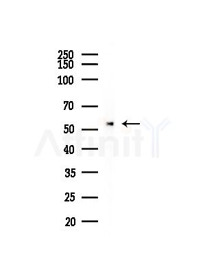 Nono Antibody - Western blot analysis of lysates from Rat lung, using Nono Antibody at 1/1000 dilution.