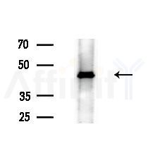 EIF4A1 Antibody - Western blot analysis of extracts from various samples, using EIF4A1 Antibody at 1/1000 dilution.