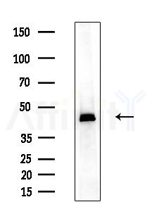 EIF4A1 Antibody - Western blot analysis of extracts from EC304 cells
(heat-shock treatment), using EIF4A1 Antibody at 1/1000 dilution.