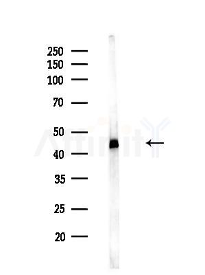 EIF4A1 Antibody - Western blot analysis of lysates from EC304 cells(heat-shock treatment), using EIF4A1 Antibody at 1/1000 dilution.