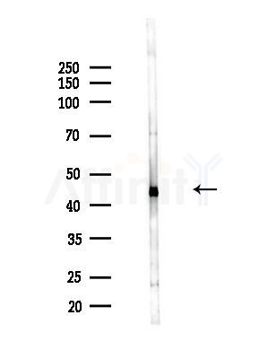 EIF4A1 Antibody - Western blot analysis of lysates from B16F10-LUC cells(LPS,4h treatment), using EIF4A1 Antibody at 1/1000 dilution.
