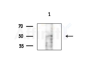 CHRNB1 Antibody - Western blot analysis of extracts from Mouse testis, using CHRNB1 Antibody at 1/1000 dilution.