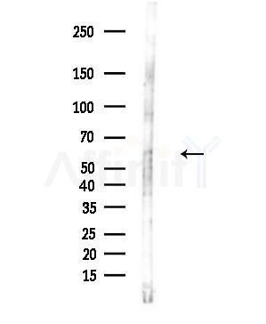 CHRNB1 Antibody - Western blot analysis of lysates from 293 cells(starvation,24h treatment), using CHRNB1 Antibody at 1/1000 dilution.