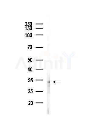 AIMP1 Antibody - Western blot analysis of lysates from LoVo cells(heat-shock,45min treatment), using AIMP1 Antibody at 1/1000 dilution.