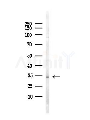 AIMP1 Antibody - Western blot analysis of lysates from MDA-MB-231 cells(heat-shock,45min treatment), using AIMP1 Antibody at 1/1000 dilution.