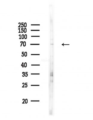 C10orf2 Antibody - Western blot analysis of lysates from COLO205 cells(heat-shock,45min treatment), using C10orf2 Antibody at 1/1000 dilution.