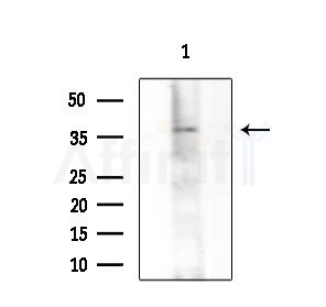 CHRNA1 Antibody - Western blot analysis of extracts from Mouse brain, using CHRNA1 Antibody at 1/1000 dilution.