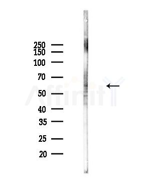 PDZK1 Antibody - Western blot analysis of lysates from Hela cells(heat-shock,45min treatment), using PDZK1 Antibody at 1/1000 dilution.