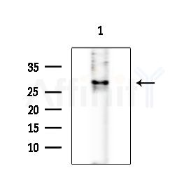 PKA beta Antibody - Western blot analysis of extracts from Rat liver, using PKA beta Antibody at 1/1000 dilution.