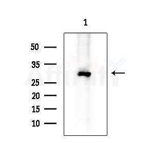 PKA beta Antibody - Western blot analysis of extracts from K562 cells, using PKA beta Antibody at 1/1000 dilution.