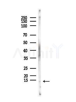 S100A12 Antibody - Western blot analysis of lysates from Mouse brain, using S100A12 Antibody at 1/1000 dilution.