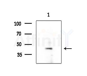 SERPINE2 Antibody - Western blot analysis of extracts from EC304 cells, using SERPINE2 Antibody at 1/1000 dilution.