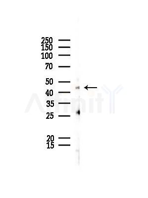 SERPINE2 Antibody - Western blot analysis of lysates from EC304 cells, using SERPINE2 Antibody at 1/1000 dilution.