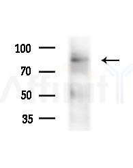 HADHA Antibody - Western blot analysis of lysates from Mouse testis, using HADHA Antibody at 1/1000 dilution.