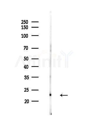HDGF Antibody - Western blot analysis of lysates from HUVEC cellsLPS, using HDGF Antibody at 1/1000 dilution.