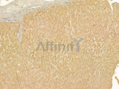 NEK2 Antibody - DF7296 at 1/100 staining human normal liver tissue by IHC-P.
