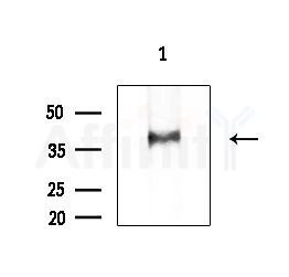 SDCBP Antibody - Western blot analysis of extracts from COLO205 cells, using SDCBP Antibody at 1/1000 dilution.