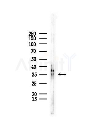 SDCBP Antibody - Western blot analysis of lysates from COLO205 cells, using SDCBP Antibody at 1/1000 dilution.