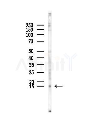 TCEB2 Antibody - Western blot analysis of lysates from EC304 cells, using TCEB2 Antibody at 1/1000 dilution.